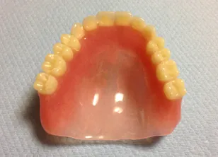 保険適用 全部床義歯