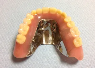 自由診療 全部床義歯